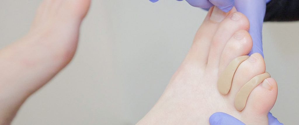 Ortesis de silicona en Rubí