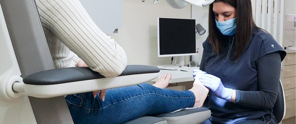 Tratamiento de onicomicosis en Rubí
